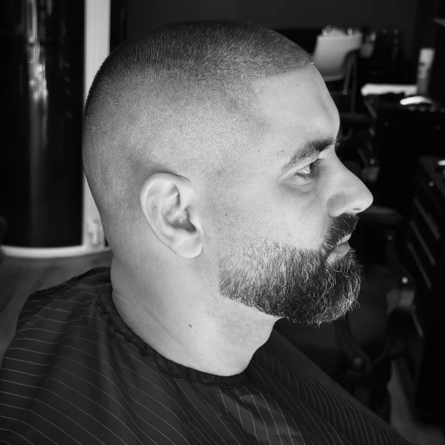 Real client result at Vintage Studio in Sliema